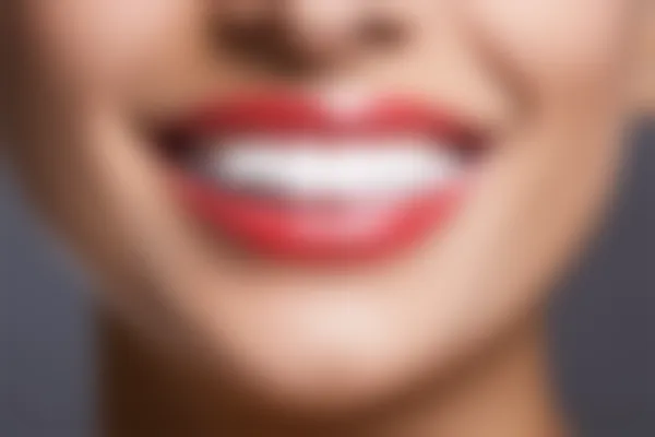 优惠价仅需2500元起，太原鼎植口腔医院烤瓷牙价格从3000元起起，机会难得，速来预约！