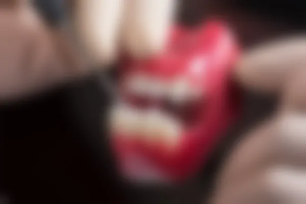 南宁岭南口腔门诊部种植牙医生推荐，了解南宁种牙价格与服务，2026年最新信息分享