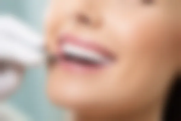 重庆团圆口腔医院2026年种植牙与正畸项目价格表，真实透明，值得关注的选择