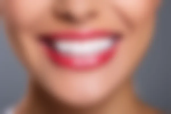 珠海诺雅美口腔门诊部龋齿填充价格表：原价800元起，现仅需600元起，让您轻松拥有健康美丽的牙齿！