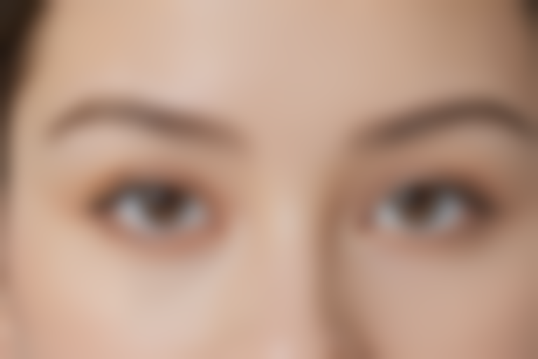 衡阳衡山瑞欣眼科医院2026版价目大全:双眼弱视手术价格8306元起