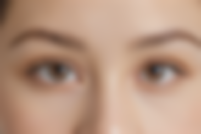 北京悦秀医疗美容门诊部假体隆鼻的费用为9800元起，现在优惠价仅需7800元起，优异机会，赶快来开启你的美丽之旅！