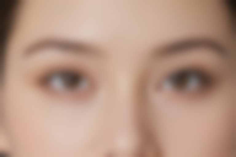 沈阳爱尔杰出眼科医院近视手术费用详报2026:Ticl晶体植入+激光近视眼矫正价格43388元起