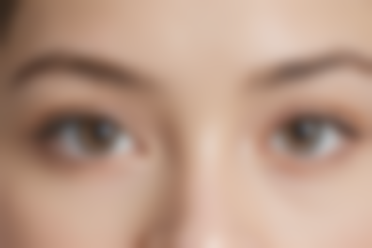 华厦渝州眼科医院近视手术的经济成本:白内障多焦点人工晶体价格19644元起