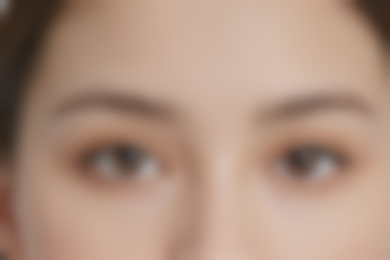 亳州缔美医疗整形美容诊所韩风双眼皮成形术现推出优惠价，原价6800元起现仅需4800元起，价目表详解让您轻松美容！