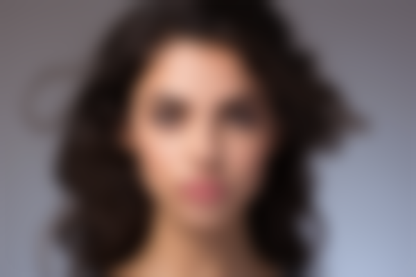 深圳璧丽维纳医疗美容门诊部肉毒素项目评测：效果如何？