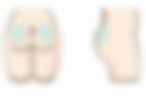 上海华美医美冰点脱毛技术和口碑怎么样？