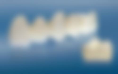 乌鲁木齐牙博士口腔医院收费贵吗？专精方案与合理价格