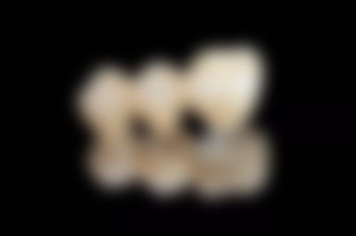 乌鲁木齐牙博士口腔牙冠修复咋样？牙齿缺损别发愁，牙冠修复来拯救焕新笑容 