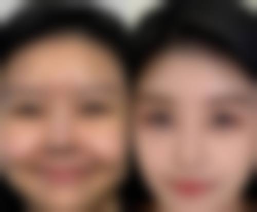 孝感黄清雨时光整形营业时间