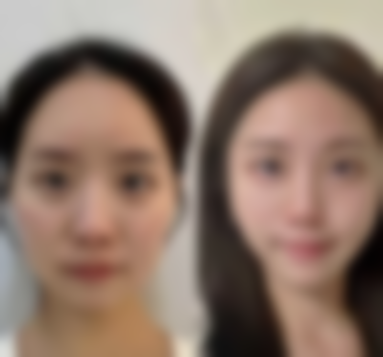 天津雅之兰医美医疗美容诊所医院技术好不好?