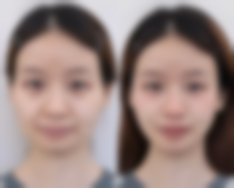 总结——天津雅之兰医美医疗美容诊所怎么样?