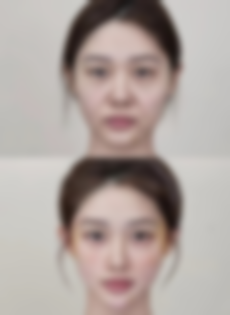 深圳贝加美医疗美容门诊部医院技术好不好？