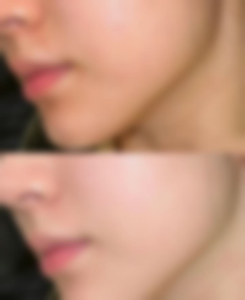 宁波美莱整形美容医院收费标准参考