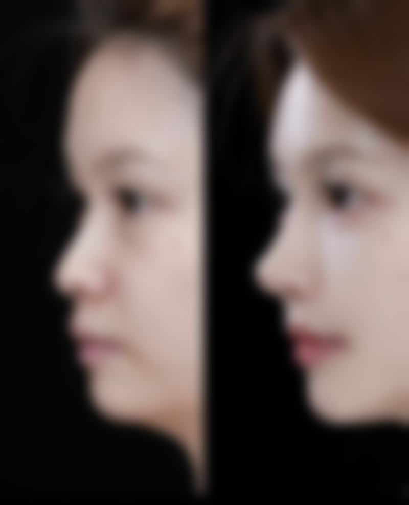 成都市妇女儿童中 心医院医疗美容科收费标准参考