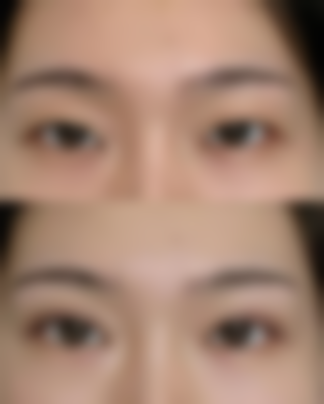 总结——昆明明美医学美容部怎么样?