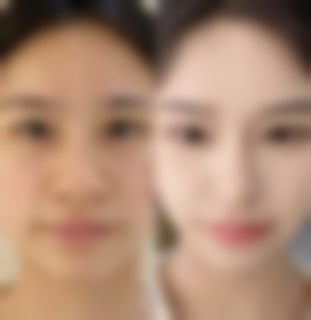 泰国曼谷F CLINIC医美诊所收费标准参考