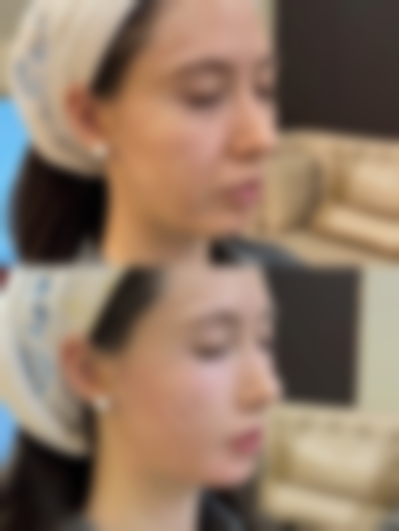 桐城德尔美客医疗美容门诊部口碑如何？