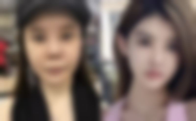 总结——韩国DA - EAT韩医院方敏宇医生怎么样？