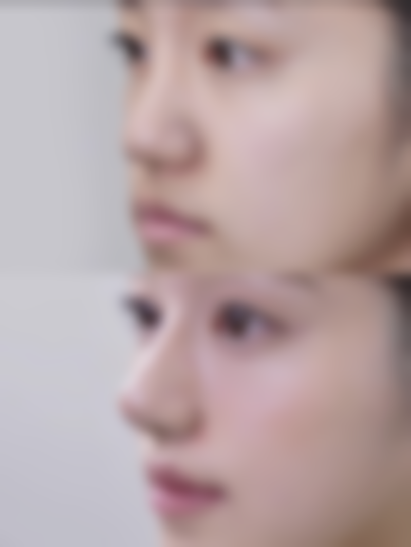 韩国心动Sulleim整形外科电话号码及预约方法