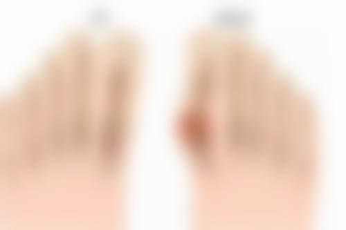 南京军区南京总院烧伤整形科口碑如何？