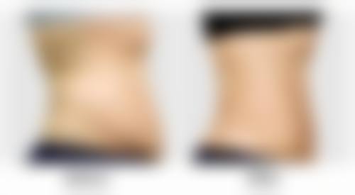 武汉水母医学美容诊所收费标准参考