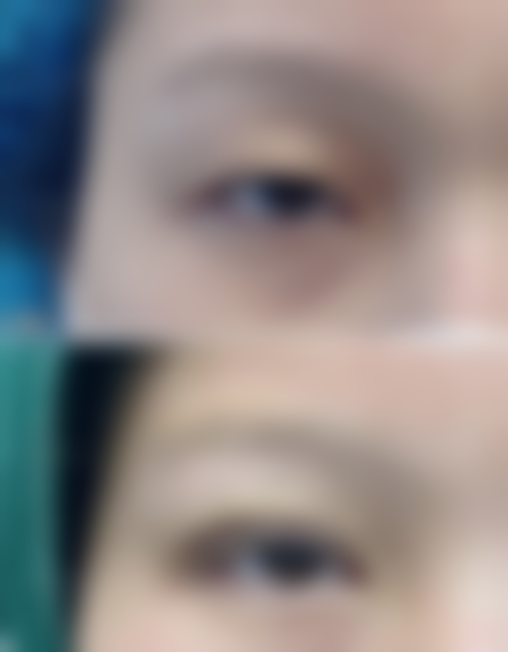 韩国鼻整形研究所 