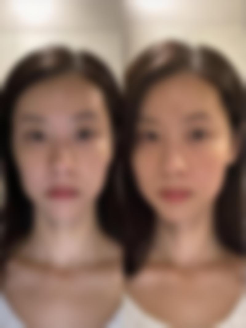 总结——韩国鼻整形研究所 