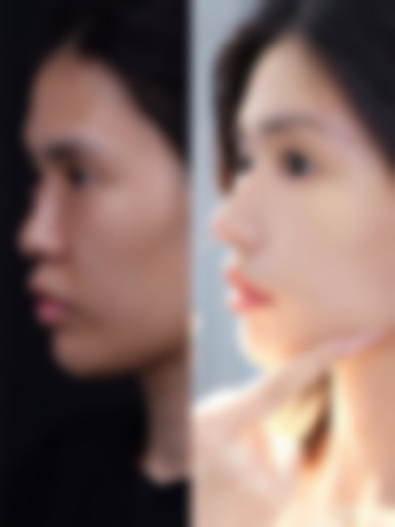 总结——成都川美医疗美容诊所怎么样？