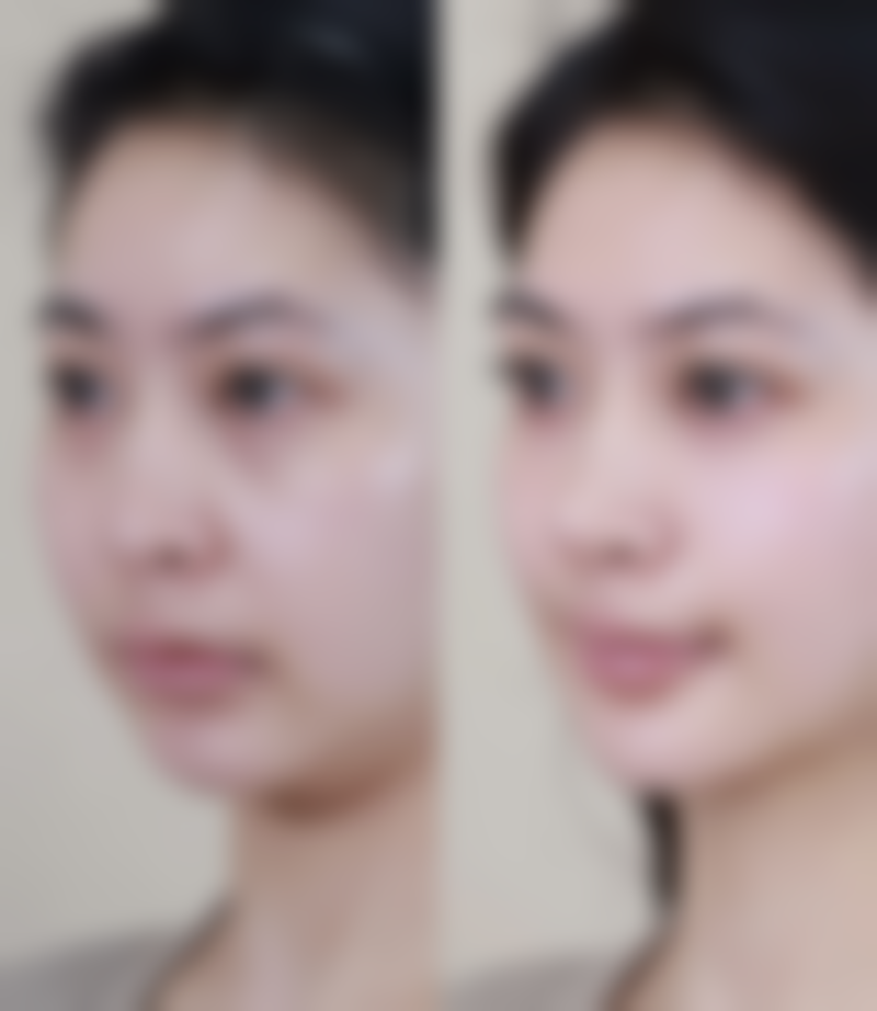 总结——新疆维蜜医学美容门诊部怎么样？