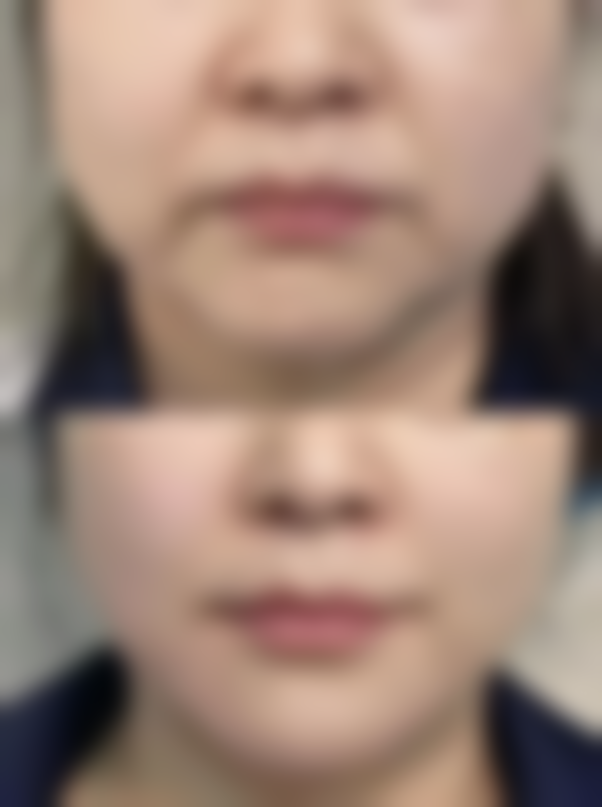 新疆维蜜医学美容门诊部口碑如何？