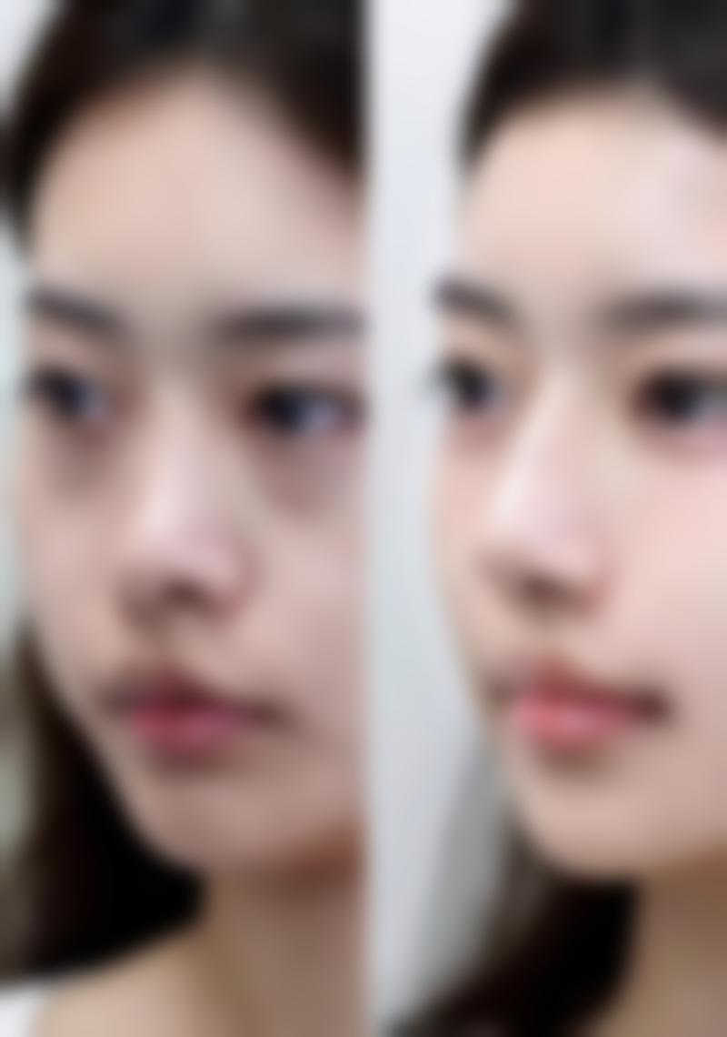 成都川美医疗美容诊所医院技术好不好？