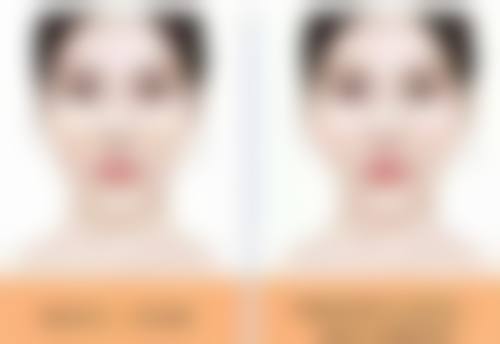 衡阳凡美医疗美容门诊部医院技术好不好？