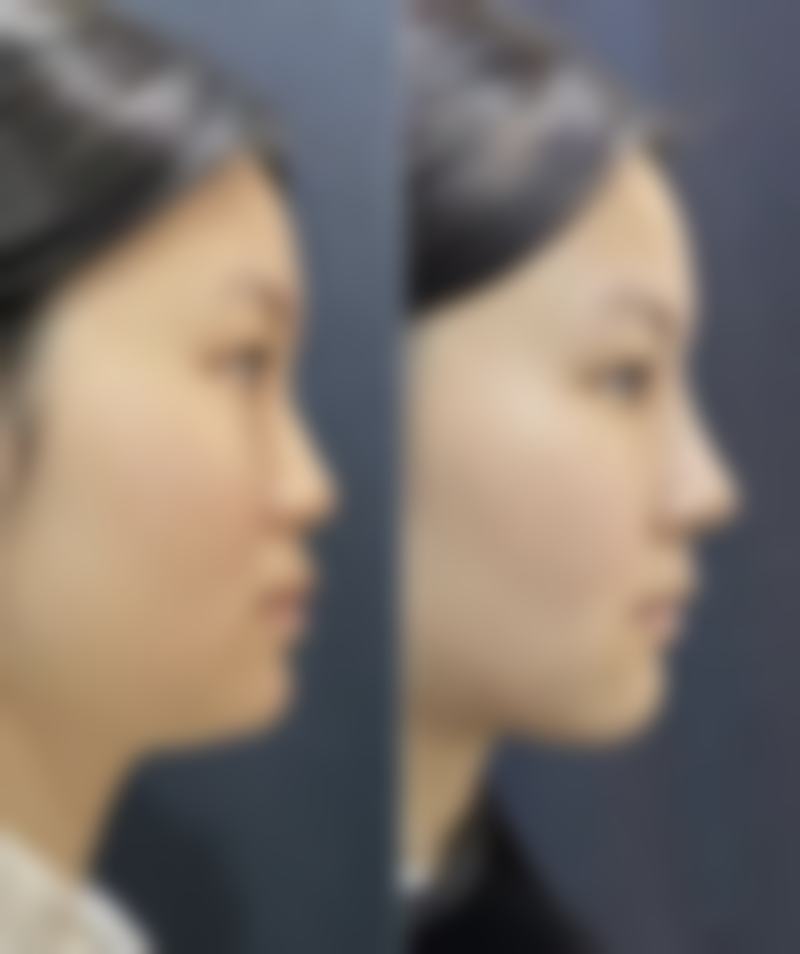 韩国星星整形外科医院 