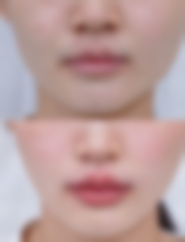 湖北江汉油田总医院整形美容科医院技术好不好?