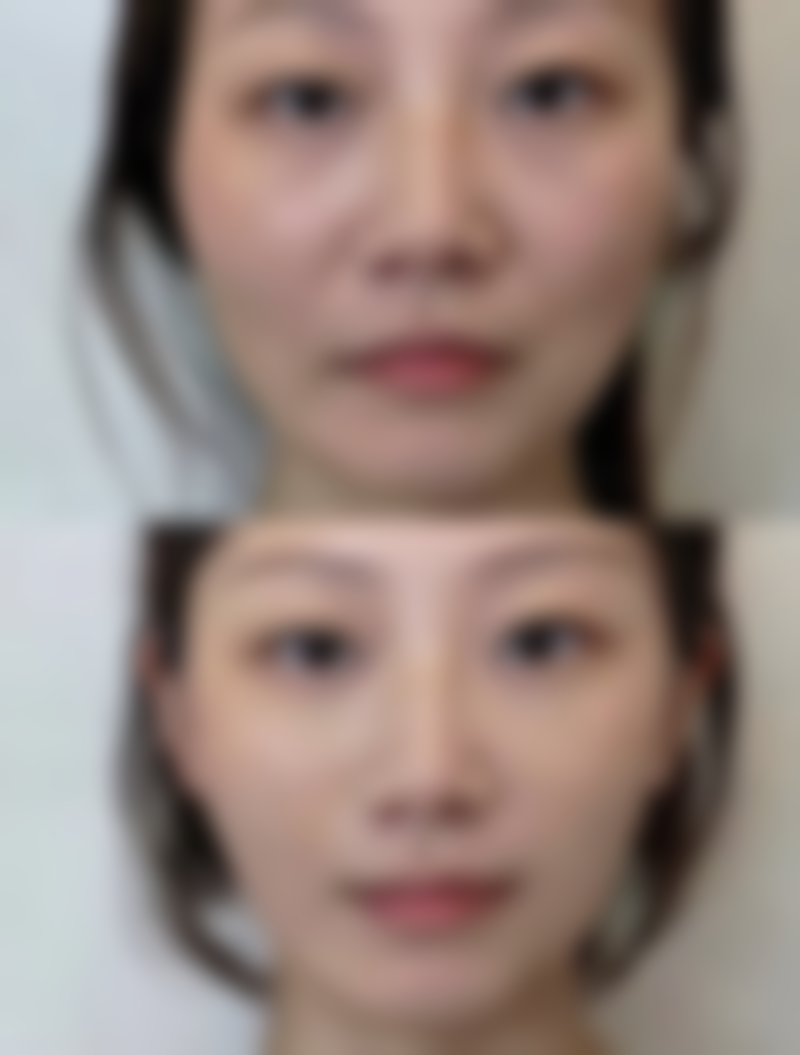 总结——昆明时光医疗美容怎么样？