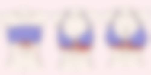 怎样让小阴唇自然缩小？从生活习惯、局部护理、饮食、锻炼和减肥多方面入手