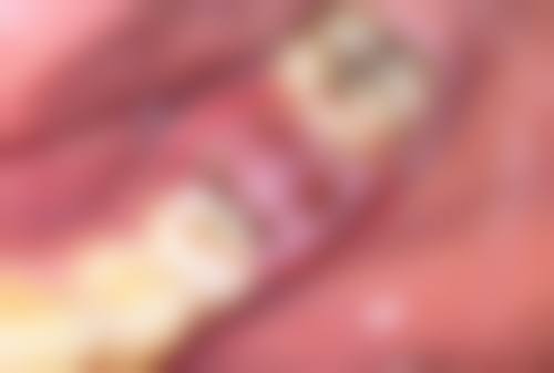 南京维多利亚医疗美容医院收费标准参考