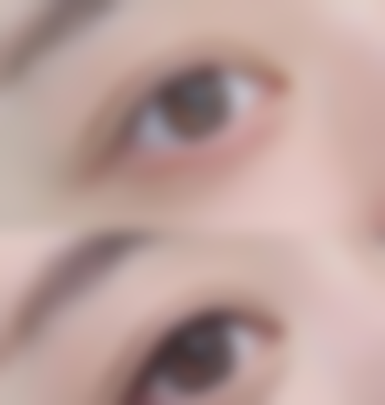 河源德康医院医疗美容科口碑如何？