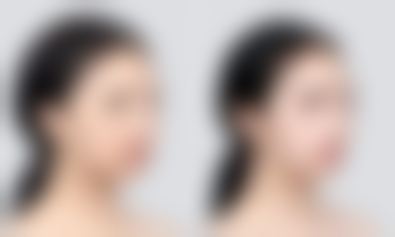 总结——哈尔滨韩大一美医疗美容门诊部怎么样？