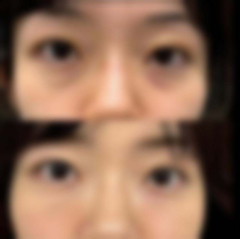 额尔古纳拉布大林王莹整形医院收费标准参考