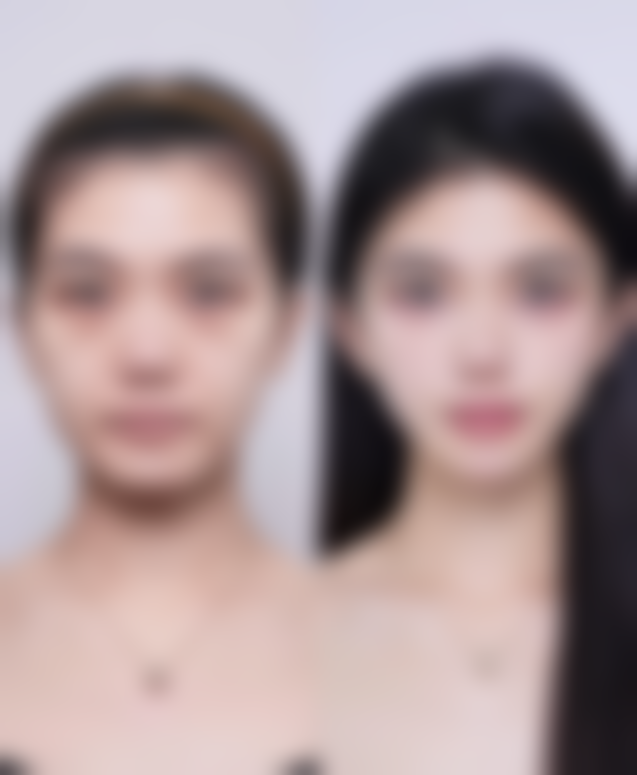 河源德康医院医疗美容科医院技术好不好？