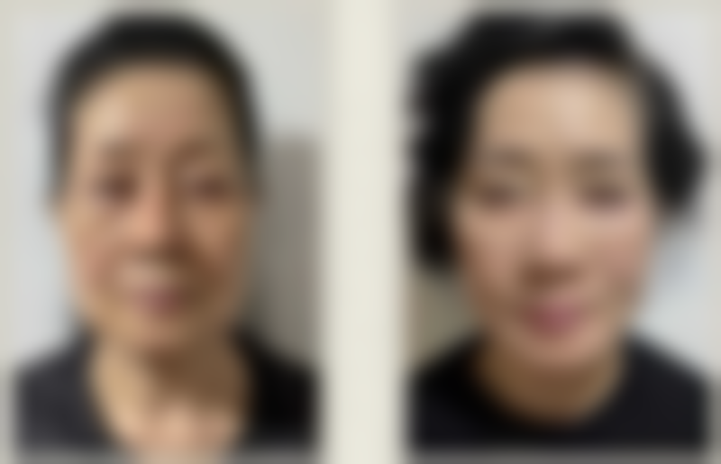 配合其他方法,成效更佳