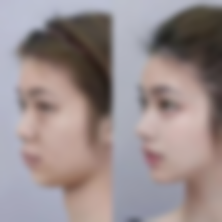 去眼袋细纹比较好的眼霜有哪些？时贝兰等多款眼霜及使用注意来揭晓