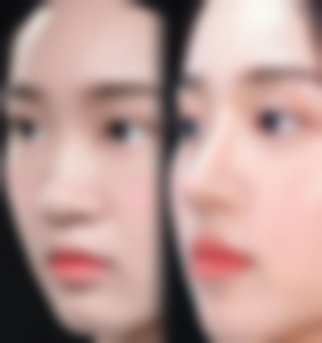 韩国美Q美容整形外科医院技术好不好？