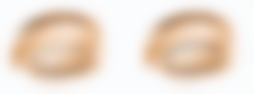 青岛海伦整形美容医院收费标准参考