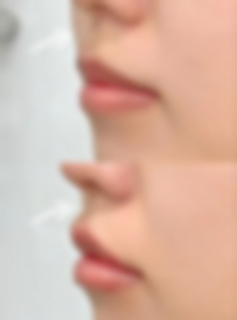 如何做好术前术后护理