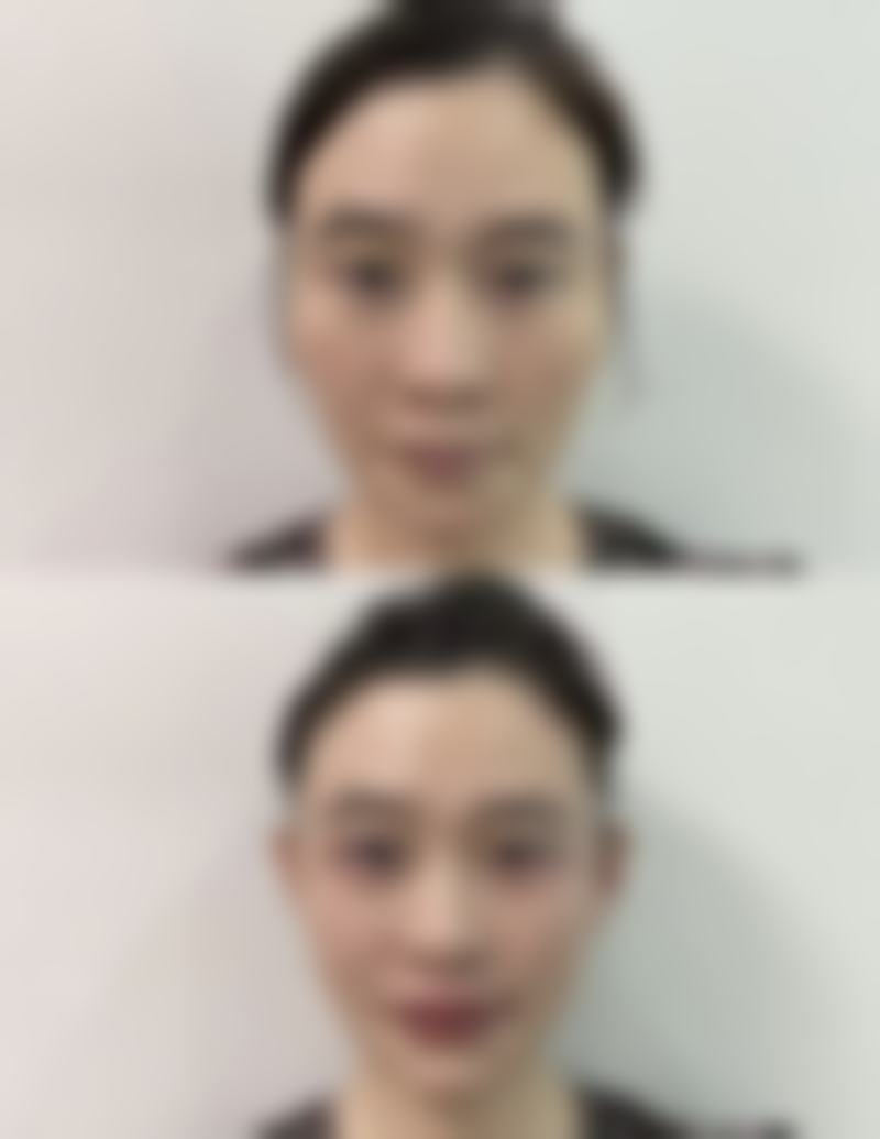 通辽张大夫医疗整形美容院收费标准参考