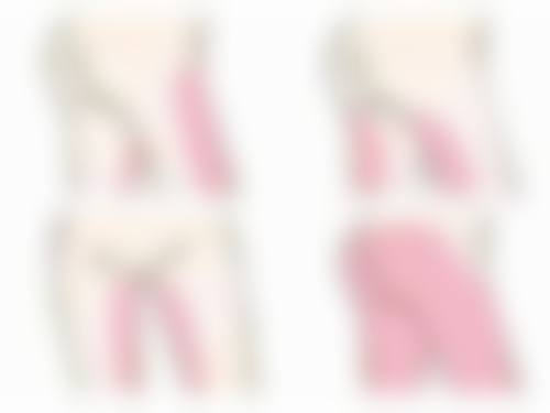 渭南凡尔赛明雅医疗美容诊所医院技术好不好？