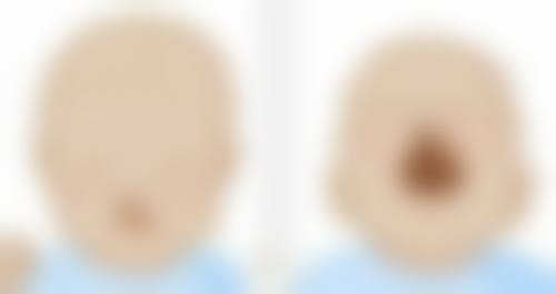 成都正美整形医院口碑如何?